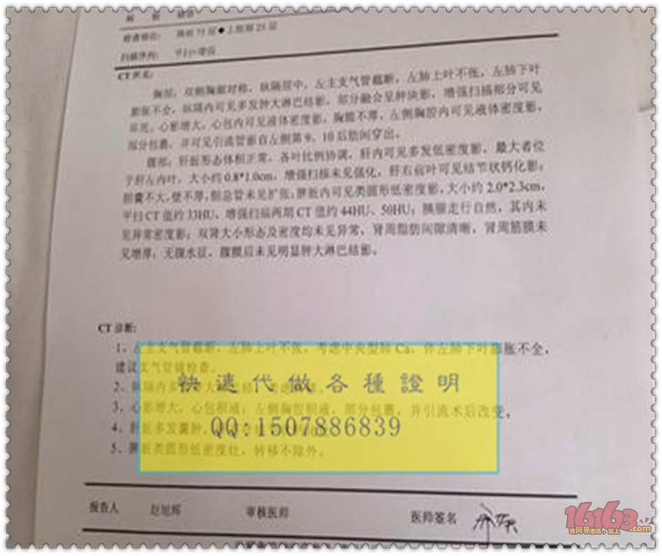 抑郁症诊断证明,住院证明,病危通知书样本,阑尾炎诊断证明样本