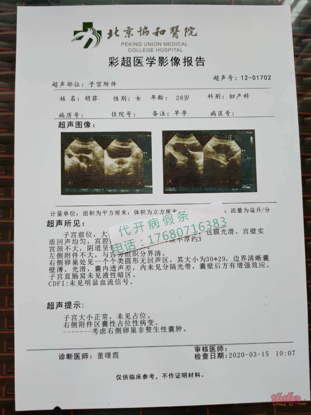 讲看看乳房*怀孕7周*8周 b超单子 怀孕b超 检查报告单 怀孕 诊断证明