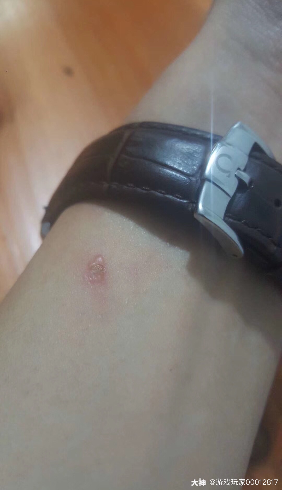 烟是个好东西,不小心烫一下还能让自己清醒.